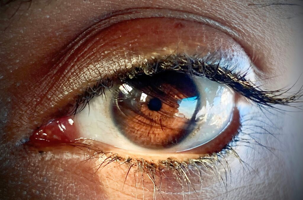 LASIK Cost in Japan