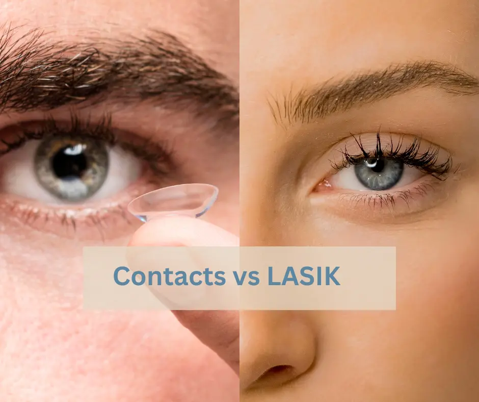 LASIK vs contact lenses in Japan